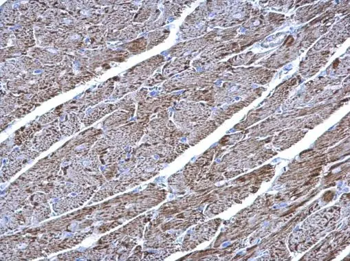 UQCRC1 antibody [N1N3] detects UQCRC1 protein at mitochondria on mouse heart by immunohistochemical analysis. Sample: Paraffin-embedded mouse heart. UQCRC1 antibody [N1N3] (GTX101862) diluted at 1:500. 
 Antigen Retrieval: Trilogy? (EDTA based, pH 8.0) buffer, 15min