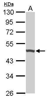 Sample (50 ug of whole cell lysate) A: Mouse brain 10% SDS PAGE GTX101862 diluted at 1:1000 Sample (50 ug of whole cell lysate) A: Mouse brain 10% SDS PAGE GTX101862 diluted at 1:1000