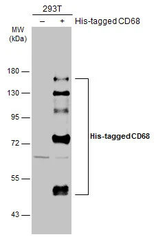 Non-transfected (–) and transfected (+) 293T whole cell extracts (30 μg) were separated by 7.5% SDS-PAGE, and the membrane was blotted with CD68 antibody (GTX101866) diluted at 1:2000. The HRP-conjugated anti-rabbit IgG antibody (GTX213110-01) was used to detect the primary antibody.