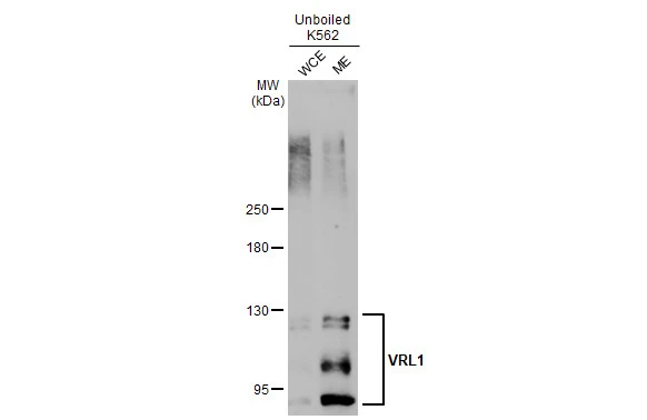 Unboiled K562 whole cell and membrane extracts (30 μg) were separated by 5% SDS-PAGE, and the membrane was blotted with VRL1 antibody [C2C3], C-term (GTX101868) diluted at 1:500. The HRP-conjugated anti-rabbit IgG antibody (GTX213110-01) was used to detect the primary antibody. (WCE: whole cell extract; ME: membrane extract)