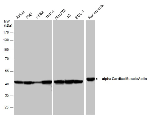 alpha Cardiac Muscle Actin antibody detects alpha Cardiac Muscle Actin protein by western blot analysis. Various whole cell extracts (30 μg) and Rat tissue extracts (50 μg) were separated by 10% SDS-PAGE, and the membrane was blotted with alpha Cardiac Muscle Actin antibody (GTX101876) diluted at a dilution of 1:10000. The HRP-conjugated anti-rabbit IgG antibody (GTX213110-01) was used to detect the primary antibody.