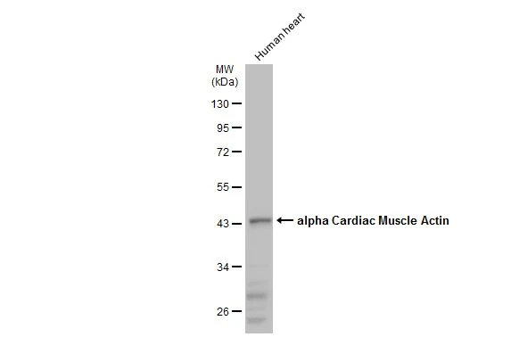 Human tissue extract (30 μg) was separated by 10% SDS-PAGE, and the membrane was blotted with alpha Cardiac Muscle Actin antibody (GTX101876) diluted at 1:1000. The HRP-conjugated anti-rabbit IgG antibody (GTX213110-01) was used to detect the primary antibody.