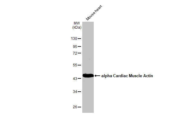 Mouse tissue extract (50 μg) was separated by 10% SDS-PAGE, and the membrane was blotted with alpha Cardiac Muscle Actin antibody (GTX101876) diluted at 1:200000. The HRP-conjugated anti-rabbit IgG antibody (GTX213110-01) was used to detect the primary antibody.