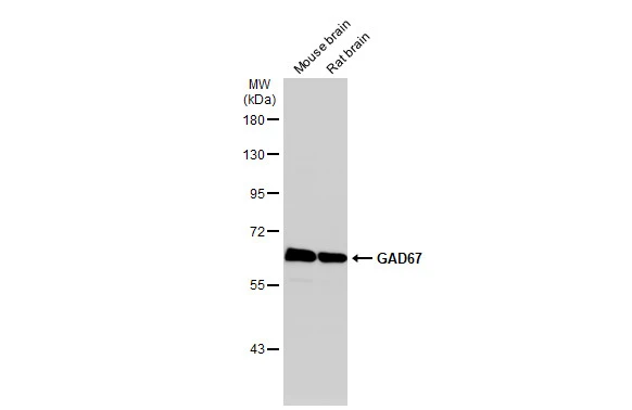 Anti-GAD67 antibody (GTX101881) | GeneTex Anti-GAD67 antibody (GTX101881) | GeneTex