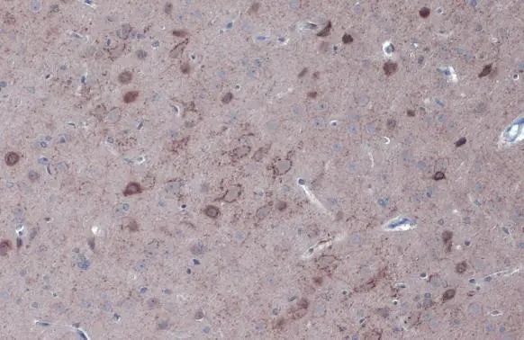 Anti-GAD67 antibody (GTX101881) | GeneTex Anti-GAD67 antibody (GTX101881) | GeneTex