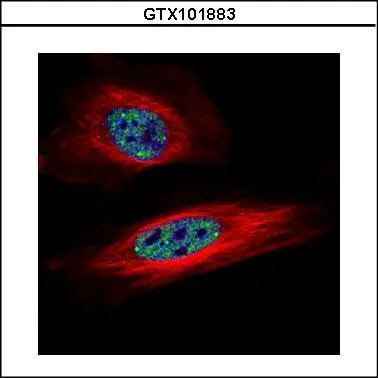 Sample (30 ug of whole cell lysate) A: HeLa nucleus 12% SDS PAGE GTX101883 diluted at 1:1000 The HRP-conjugated anti-rabbit IgG antibody (GTX213110-01) was used to detect the primary antibody.