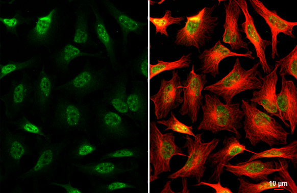 SNRPB antibody detects SNRPB protein at cytoplasm and nucleus by immunofluorescent analysis. Sample: HeLa cells were fixed in 4% paraformaldehyde at RT for 15 min. Green: SNRPB stained by SNRPB antibody (GTX101883) diluted at 1:500. Red: alpha Tubulin, a cytoskeleton marker, stained by alpha Tubulin antibody [GT114] (GTX628802) diluted at 1:1000. Scale bar= 10μm.