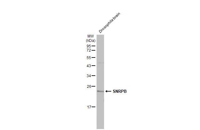 Drosophila tissue extract (50 μg) was separated by 12% SDS-PAGE, and the membrane was blotted with SNRPB antibody (GTX101883) diluted at 1:2000. The HRP-conjugated anti-rabbit IgG antibody (GTX213110-01) was used to detect the primary antibody, and the signal was developed with Trident ECL plus-Enhanced.