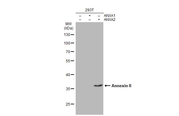 Non-transfected (–) and transfected (+) 293T whole cell extracts (30 μg) were separated by 10% SDS-PAGE, and the membrane was blotted with Annexin II antibody (GTX101902) diluted at 1:1000. The HRP-conjugated anti-rabbit IgG antibody (GTX213110-01) was used to detect the primary antibody. Non-transfected (–) and transfected (+) 293T whole cell extracts (30 μg) were separated by 10% SDS-PAGE, and the membrane was blotted with Annexin II antibody (GTX101902) diluted at 1:1000. The HRP-conjugated anti-rabbit IgG antibody (GTX213110-01) was used to detect the primary antibody.