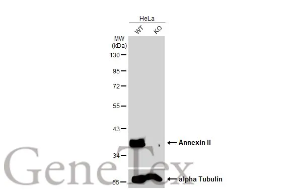 Wild-type (WT) and Annexin II knockout (KO) HeLa cell extracts (30 μg) were separated by 10% SDS-PAGE, and the membrane was blotted with Annexin II antibody (GTX101902) diluted at 1:10000. The HRP-conjugated anti-rabbit IgG antibody (GTX213110-01) was used to detect the primary antibody. Wild-type (WT) and Annexin II knockout (KO) HeLa cell extracts (30 μg) were separated by 10% SDS-PAGE, and the membrane was blotted with Annexin II antibody (GTX101902) diluted at 1:10000. The HRP-conjugated anti-rabbit IgG antibody (GTX213110-01) was used to detect the primary antibody.