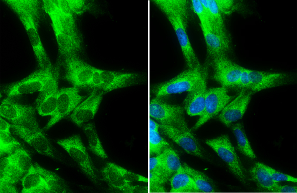 Cytochrome b5 antibody detects Cytochrome b5 protein at cytoplasm by immunofluorescent analysis. Sample: PG-4 cells were fixed in 4% paraformaldehyde at RT for 15 min. Green: Cytochrome b5 stained by Cytochrome b5 antibody (GTX101909) diluted at 1:500. Blue: Hoechst 33342 staining.