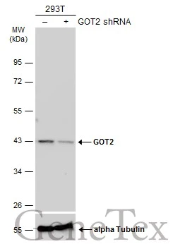 Non-transfected (–) and transfected (+) 293T whole cell extracts (30 μg) were separated by 10% SDS-PAGE, and the membrane was blotted with GOT2 antibody (GTX101930) diluted at 1:20000. The HRP-conjugated anti-rabbit IgG antibody (GTX213110-01) was used to detect the primary antibody.