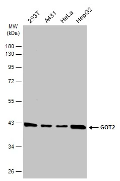 GOT2 antibody