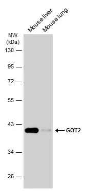GOT2 antibody