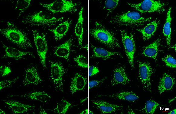 GOT2 antibody detects GOT2 protein at mitochondria by immunofluorescent analysis. Sample: HeLa cells were fixed in ice-cold MeOH for 5 min. Green: GOT2 stained by GOT2 antibody (GTX101930) diluted at 1:500. Blue: Hoechst 33342 staining. Scale bar= 10 μm.