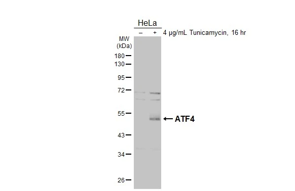 Untreated (–) and treated (+) HeLa whole cell extracts (30 μg) were separated by 10% SDS-PAGE, and the membrane was blotted with ATF4 antibody (GTX101943) diluted at 1:1000. The HRP-conjugated anti-rabbit IgG antibody (GTX213110-01) was used to detect the primary antibody.