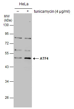 ATF4 antibody detects ATF4 protein by western blot analysis. Un-treated (-) and treated (+, 4 μg/ml tunicamycin treatment ) HeLa whole cell extracts (30 μg) were separated by 10% SDS-PAGE, and the membrane was blotted with ATF4 antibody (GTX101944) diluted at 1:500.