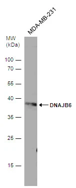 Whole cell extract (30 μg) was separated by 12% SDS-PAGE, and the membrane was blotted with DNAJB6 antibody [N3C3] (GTX101947) diluted at 1:500.