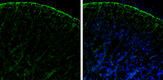 PHGDH antibody [N1N2], N-term detects PHGDH protein by immunohistochemical analysis. Sample: Frozen-sectioned rat E13.5 brain. Green: PHGDH stained by PHGDH antibody [N1N2], N-term (GTX101948) diluted at 1:250. Blue: Fluoroshield with DAPI (GTX30920).