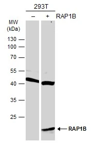 Non-transfected (–) and transfected (+) 293T whole cell extracts (30 μg) were separated by 12% SDS-PAGE, and the membrane was blotted with RAP1B antibody (GTX101950) diluted at 1:500. The HRP-conjugated anti-rabbit IgG antibody (GTX213110-01) was used to detect the primary antibody.