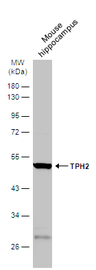 Mouse tissue extract (50 μg) was separated by 10% SDS-PAGE, and the membrane was blotted with TPH2 antibody [N3C3] (GTX101962) diluted at 1:1000. The HRP-conjugated anti-rabbit IgG antibody (GTX213110-01) was used to detect the primary antibody.