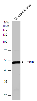 Mouse tissue extract (50 μg) was separated by 10% SDS-PAGE, and the membrane was blotted with TPH2 antibody [N3C3] (GTX101962) diluted at 1:1000. The HRP-conjugated anti-rabbit IgG antibody (GTX213110-01) was used to detect the primary antibody.