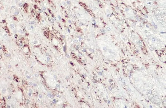 TPH2 antibody [N3C3] detects TPH2 protein at cell membrane by immunohistochemical analysis. Sample: Paraffin-embedded rat brain. TPH2 stained by TPH2 antibody [N3C3] (GTX101962) diluted at 1:500. Antigen Retrieval: Citrate buffer, pH 6.0, 15 min