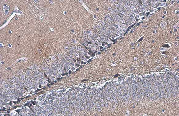 OTUB1 antibody [N1C1] detects OTUB1 protein at cytoplasm by immunohistochemical analysis. Sample: Paraffin-embedded mouse hippocampus. OTUB1 stained by OTUB1 antibody [N1C1] (GTX101973) diluted at 1:500. Antigen Retrieval: Citrate buffer, pH 6.0, 15 min