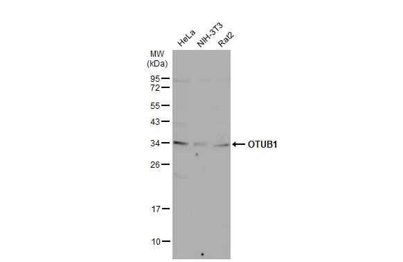 Various whole cell extracts (30 μg) were separated by 12% SDS-PAGE, and the membrane was blotted with OTUB1 antibody [N1C1] (GTX101973) diluted at 1:1000. The HRP-conjugated anti-rabbit IgG antibody (GTX213110-01) was used to detect the primary antibody, and the signal was developed with Trident ECL plus-Enhanced.