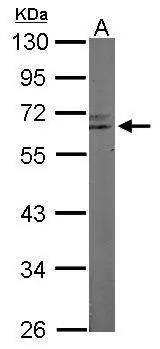 Sample (50 ug of whole cell lysate) A: Mouse brain 10% SDS PAGE GTX101983 diluted at 1:1000