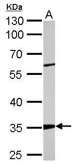 ARPC2 antibody detects ARPC2 protein by western blot analysis. A. 50 μg mouse kidney lysate/extract 10% SDS-PAGE ARPC2 antibody (GTX101984) dilution: 1:2000 The HRP-conjugated anti-rabbit IgG antibody (GTX213110-01) was used to detect the primary antibody.