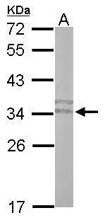 Sample (50 ug of whole cell lysate) A: mouse stomach 12% SDS PAGE GTX101987 diluted at 1:500 Sample (50 ug of whole cell lysate) A: mouse stomach 12% SDS PAGE GTX101987 diluted at 1:500