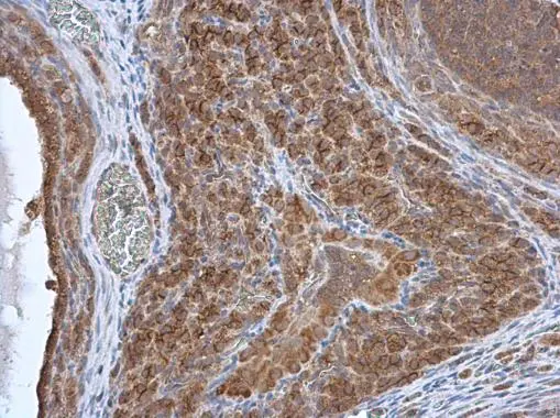 HAX1 antibody detects HAX1 protein at cytoplasm in rat ovary by immunohistochemical analysis. Sample: Paraffin-embedded rat ovary. HAX1 antibody (GTX101992) diluted at 1:500. 
 Antigen Retrieval: Citrate buffer, pH 6.0, 15 min