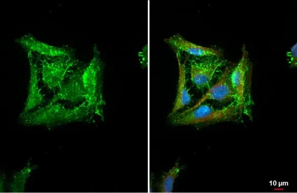 HAX1 antibody detects HAX1 protein at cell membrane by immunofluorescent analysis. Sample: HeLa cells were fixed in ice-cold MeOH for 5 min. Green: HAX1 stained by HAX1 antibody (GTX101992) diluted at 1:500. Red: alpha Tubulin, a cytoskeleton marker, stained by alpha Tubulin antibody [GT114] (GTX628802) diluted at 1:1000. Blue: Fluoroshield with DAPI (GTX30920).