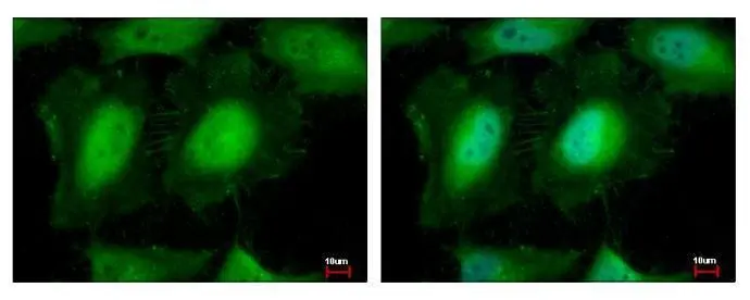 EIF3K antibody [N1C2] detects EIF3K protein at cytoplasm and nucleus by immunofluorescent analysis.