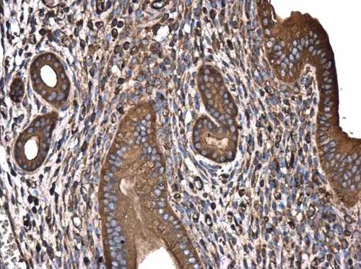 GABARAPL2 antibody detects GABARAPL2 protein at cytoplasm in mouse cervix by immunohistochemical analysis. Sample: Paraffin-embedded mouse cervix. GABARAPL2 antibody (GTX102006) diluted at 1:200. 
 Antigen Retrieval: Citrate buffer, pH 6.0, 15 min