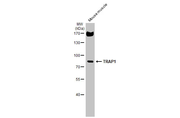 Mouse tissue extract (50 μg) was separated by 7.5% SDS-PAGE, and the membrane was blotted with TRAP1 antibody (GTX102017) diluted at 1:1000. The HRP-conjugated anti-rabbit IgG antibody (GTX213110-01) was used to detect the primary antibody.
