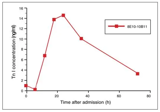 Cardiac troponin I measurements using sandwich immunoassays to determine the total cardiac troponin I in serial blood samples from AMI patient. Cardiac troponin I measurements using sandwich immunoassays to determine the total cardiac troponin I in serial blood samples from AMI patient.