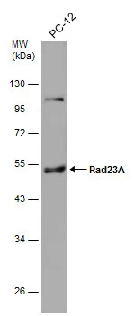 Whole cell extract (30 μg) was separated by 10% SDS-PAGE, and the membrane was blotted with Rad23A antibody [N3C3] (GTX102032) diluted at 1:1000.