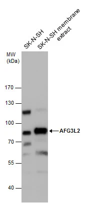 AFG3L2 antibody detects AFG3L2 protein by western blot analysis. SK-N-SH whole cell extracts and membrane extracts (30 μg) were separated by 7.5% SDS-PAGE, and the membrane was blotted with AFG3L2 antibody (GTX102036) diluted at 1:1000.