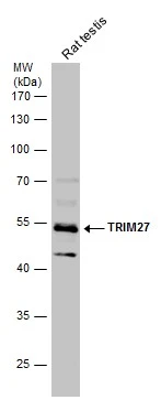 Rat tissue extract (50 μg) was separated by 10% SDS-PAGE, and the membrane was blotted with TRIM27 antibody (GTX102048) diluted at 1:500.
