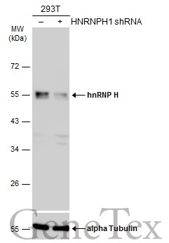Non-transfected (–) and transfected (+) 293T whole cell extracts (30 μg) were separated by 10% SDS-PAGE, and the membrane was blotted with hnRNP H antibody [N1C1] (GTX102061) diluted at 1:10000. The HRP-conjugated anti-rabbit IgG antibody (GTX213110-01) was used to detect the primary antibody.