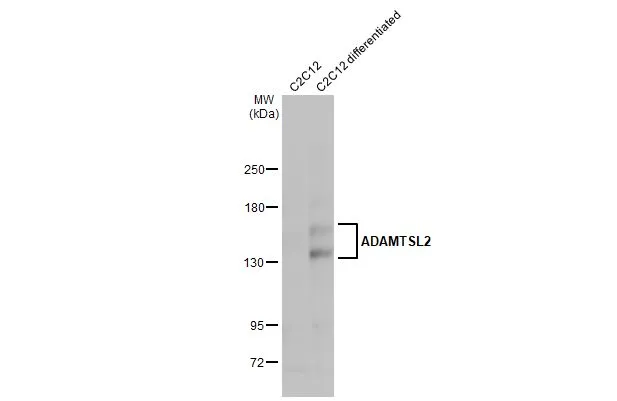 Anti-ADAMTSL2 antibody [C3], C-term (GTX102069) | GeneTex