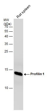 Rat tissue extract (50 μg) was separated by 15% SDS-PAGE, and the membrane was blotted with Profilin 1 antibody [N1C3] (GTX102072) diluted at 1:500.