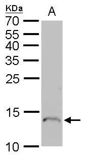 Profilin 1 antibody detects Profilin 1 protein by Western blot analysis. A. 50 μg mouse spleen lysate/extract 15 % SDS-PAGE Profilin 1 antibody (GTX102072) dilution: 1:500 Profilin 1 antibody detects Profilin 1 protein by Western blot analysis. A. 50 μg mouse spleen lysate/extract 15 % SDS-PAGE Profilin 1 antibody (GTX102072) dilution: 1:500