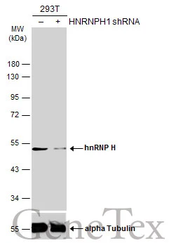 Non-transfected (–) and transfected (+) 293T whole cell extracts (30 μg) were separated by 10% SDS-PAGE, and the membrane was blotted with hnRNP H antibody [C1C3] (GTX102083) diluted at 1:1000. The HRP-conjugated anti-rabbit IgG antibody (GTX213110-01) was used to detect the primary antibody.