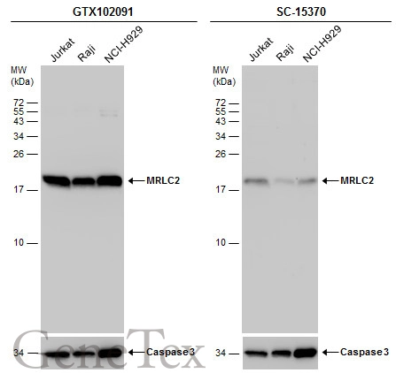 Various whole cell extracts (30 μg) were separated by 15% SDS-PAGE, and the membranes were blotted with MRLC2 antibody (GTX102091) diluted at 1:5000 and competitor's antibody (SC-15370) diluted by 1:200.