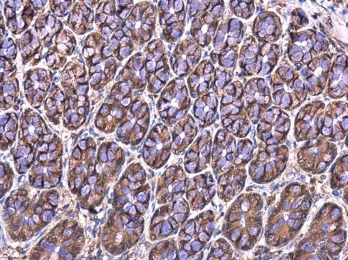 MRPL23 antibody [N1C3] detects MRPL23 protein at cytoplasm in rat colon by immunohistochemical analysis. Sample: Paraffin-embedded rat colon. MRPL23 antibody [N1C3] (GTX102094) diluted at 1:100. 
 Antigen Retrieval: Citrate buffer, pH 6.0, 15 min