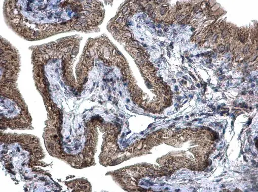 Prohibitin 2 antibody detects Prohibitin 2 protein at cytoplasm and nucleus on mouse urinary bladder by immunohistochemical analysis. Sample: Paraffin-embedded mouse urinary bladder . Prohibitin 2 antibody (GTX102100) diluted at 1:500.
Antigen Retrieval: Trilogy? (EDTA based, pH 8.0) buffer, 15min Prohibitin 2 antibody detects Prohibitin 2 protein at cytoplasm and nucleus on mouse urinary bladder by immunohistochemical analysis. Sample: Paraffin-embedded mouse urinary bladder . Prohibitin 2 antibody (GTX102100) diluted at 1:500.
Antigen Retrieval: Trilogy? (EDTA based, pH 8.0) buffer, 15min