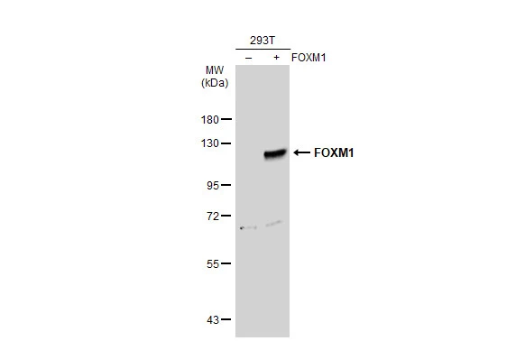 Non-transfected (–) and transfected (+) 293T whole cell extracts (30 μg) were separated by 7.5% SDS-PAGE, and the membrane was blotted with FOXM1 antibody (GTX102126) diluted at 1:500. The HRP-conjugated anti-rabbit IgG antibody (GTX213110-01) was used to detect the primary antibody. Non-transfected (–) and transfected (+) 293T whole cell extracts (30 μg) were separated by 7.5% SDS-PAGE, and the membrane was blotted with FOXM1 antibody (GTX102126) diluted at 1:500. The HRP-conjugated anti-rabbit IgG antibody (GTX213110-01) was used to detect the primary antibody.